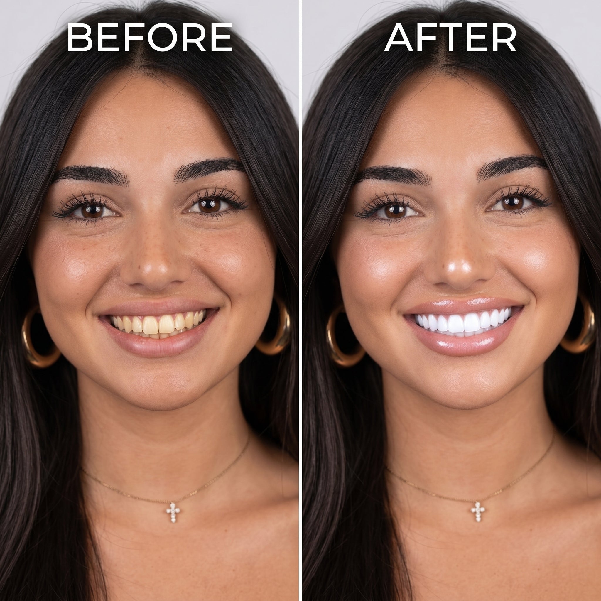 NEBULIX SmilePen before and after smile